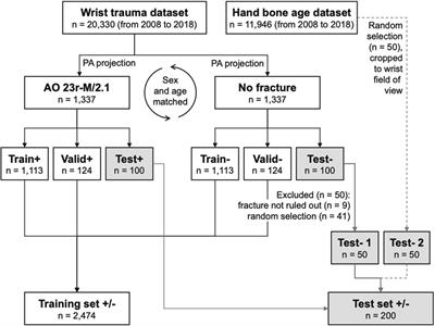 Pediatric radius torus fractures in x-rays—how computer vision could render lateral projections obsolete